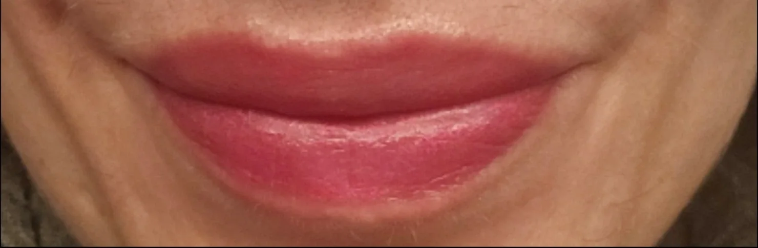 Permanent Make-up · Lippen – Direkt danach