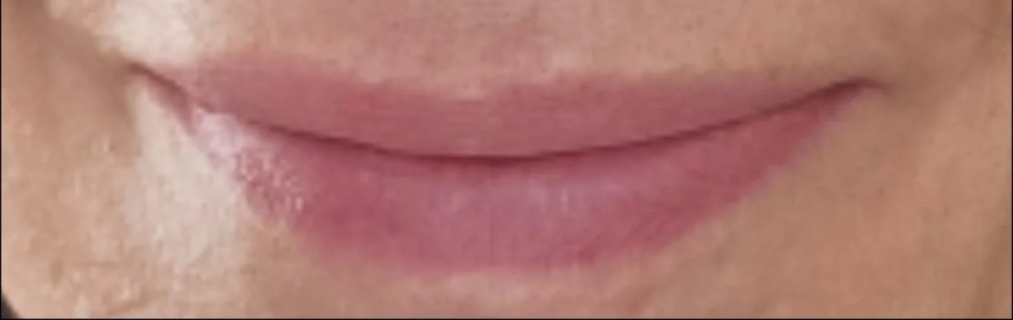 Permanent Make-up · Lippen – Abgeheilt